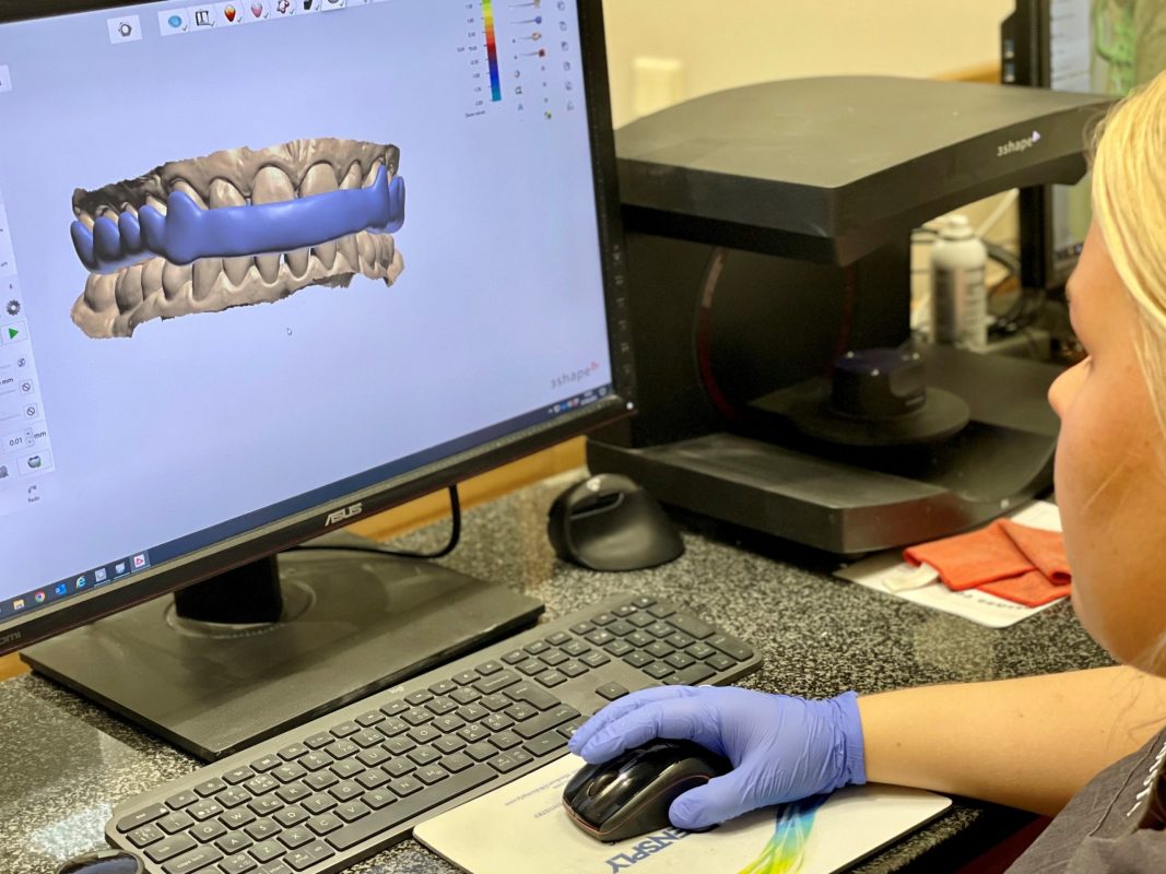 Hammaslaboranttiopiskelija suorittaa digitaalista mallinnusta tietokoneella.